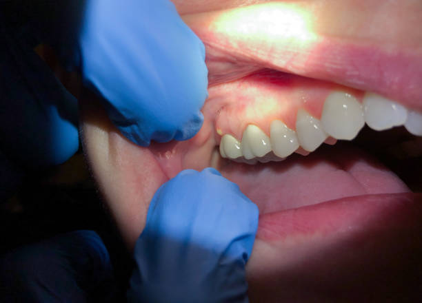 Best Mobile Emergency Dentist in Sandusky, MI